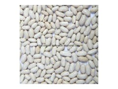 White Beans-Baishake