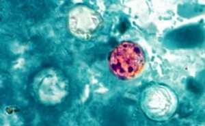 Cyclospora