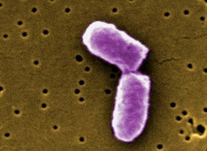 e. coli 