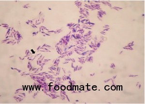 Clostridium botulinum