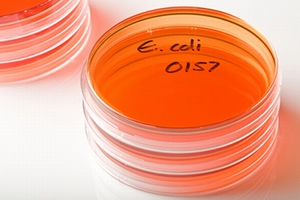 E. coli O157:H7